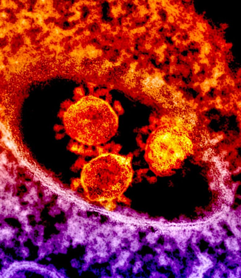 Coronavirus+particles